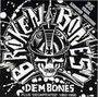 Dem Bones - Broken Bones